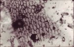 Anonymous, Microphoto #4