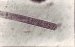 Anonymous, Microphoto #3