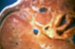 Verf., HUMAN war BODY terror AFTER aggression24