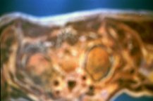 Verf., HUMAN war BODY terror AFTER aggression23
