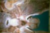 Verf., HUMAN war BODY terror AFTER aggression25