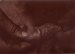 Anonymous, Skin decease #3