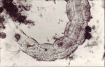 Anonymous, Microphoto #2