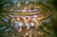 Verf., HUMAN war BODY terror AFTER aggression11