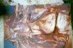 Verf., HUMAN war BODY terror AFTER aggression 2