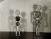 Daisy K. Smith, Two skeletons